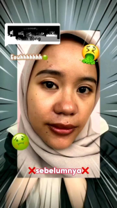Zalfa Natural Paket Lightening Glow Series