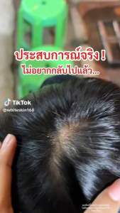 Chaba Hair Tonic 35ml 💯 Thailand