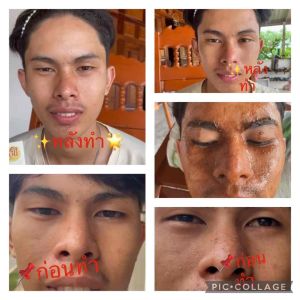 โจลีเฮิร์บ โรสฮิปออยล์ สกัดเย็น100% ออร์แกนิก Rosehip Oil Cold Pressed Organic 30Ml.นำเข้าจากเยอรมนี🇩🇪