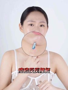 【READYSTOCK现货】🌿YEOTASKIN NATURAL HERBAL PIMPLE ACNE CREAM 🌿YEOTASKIN纯天然草本精华面霜 YEOTASKIN( APRIL 2025 BATCH)