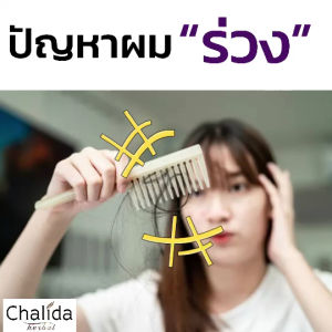 สูตรออร์แกนิคอ่อนโยนพิเศษ ชลิดา สูตรอัญชัน เซ็ท 2 ชิ้น สระด้วยแชมพู มาตา หมัก ตามที่ด้วย ทรีเท้าเม้นท์ ฟื้นผมแห้งเสียแตกปลาย ลดผมร่วง ลดความมัน ปรับสมดุล ร่วมกับชุ่มชืยผม สำหรับความหนาดกดำเงางาม หรือการจัดการควาญอีก คุณชอบดูวิธีการตามเรื่องหรือ