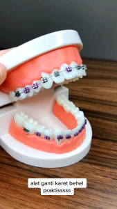 [FAST SHIPING]DENTAL Orth Ligature placement ligation gun for elastic tie band 1pcs