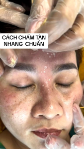 Serum Chấm tàn nhang nám sẹo rỗ Phương Anh Yody White (Mẫu Mới)