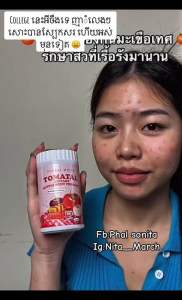 Bột cà chua trắng da Tomatal Collagen Thái Lan chính hãng giúp da trắng hơn giảm thâm mụn - Model: TCC001