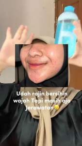 (400 ML) Garnier Micellar Cleansing Water Salicylic Blue Skin Care 400ml (Pembersih Wajah Untuk Kulit Berminyak Rentan Berjerawat dengan Salicylic Acid) - Make Up Remover