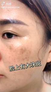 🇲🇾READY STOCK❗OMelin Whitening Moisturizing and spot-blemishing Mask欧美莲美白保湿淡斑面膜