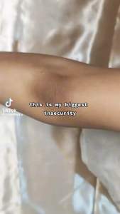 Catt & Co WHITENING SERUM - Elbow