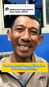 (Promo) BodyAccel Whitening Toothpaste - Perawatan Mulut Menyegarkan untuk Gigi Bersih Cocok Untuk Pria dan Wanita