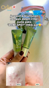 Acne Spot by Orlin Beauty 10 Gram Obat Jerawat Treatment Pengempes Samarkan Bekas Jerawat Ampuh Skincare Bpom