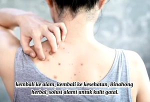 3pcs Sabun BINAHONG herbal untuk gatal akibat iritasi dan gatal menahun