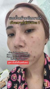 YERPALL INTENSIVE HERBAL STRAWBERRY SERUM /  INTENSIVE BIO VEGETABY ORGANIC SERUM 🔥