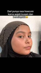 Orlin beauty Skincare Paket Brightening Platinum Mencerahkan Wajah Kulit Glowing Anti Kusam Skincare Bpom (order 1 paket dapat Dowble bonus)