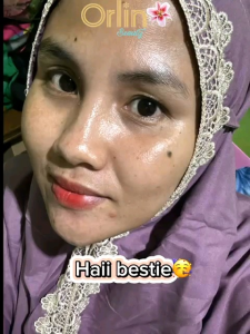 Orlin beauty PAKET FLEK PLATINUM TANPA NIGHT CREAM memudarkan flek hitam menahunmeratakan warna kulit wajah dan mencerahkan wajah