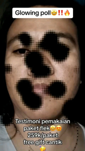 ORLIN BEAUTY SKINCARE PAKET FLEK PLATINUM - KRIM FLEK HITAM MEMBANDEL