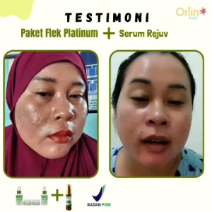 Facial Wash Flek Platinum Sabun Pembersih Wajah Flek Bandel BPOM ORI