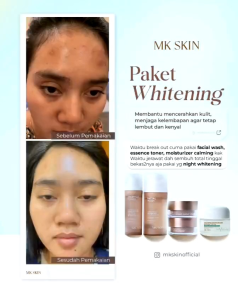 MKSKIN WHITENING SERIES