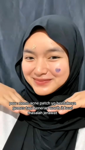 [vienna ] acne patch tea tree oil