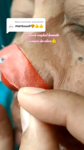 MASKER KOMEDO BPOM bySISKA CHIC Ampuh Angkat Komedo Sampai Keakar