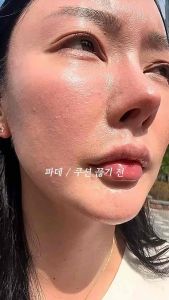 LIP O Repair Ampoule phục hồi lành thương sau xâm lấn DR PLUSCELL
