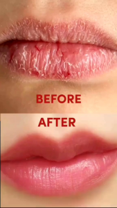 Felinz lip balm (perawatan bibir) 5g