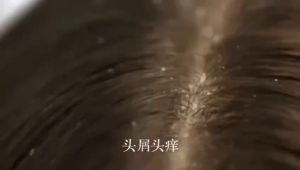 SEAWEED SHAMPOO ANTI-DANDRUFF OIL CONTROL Shampoo Anti kelemumur Melembabkan rambut Menghaluskan rambut Mengawal minyak rambut penghilang gatal kulit kepala