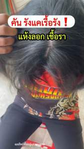 แชมพู อัญญาพญายอพลูคาว 2 ขวด เพียง 450.- จบปัญหาหนังศรีษะ เชื้อรา ผิวหนังอักเสบ กลากเกลื้อน สมุนไพร100%