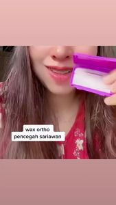 Wax Ortho | Lilin Behel Anti Sariawan | Lilin pelindung dari sariawan