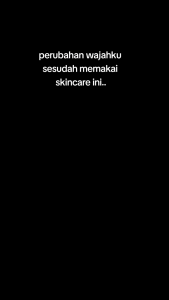 Paket Flek Platinum Orlin Beauty Original: Solusi Flek Hitam Alami