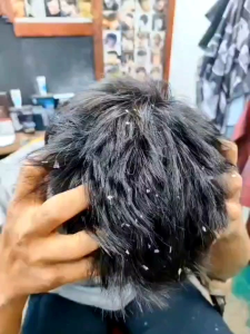 Masalah Kelemumur  Scalp Scrub Anti Dandruff Treatment