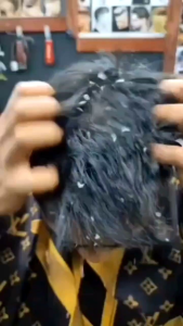 Masalah Kulit Kepala Kelemumur Kulit Kepala Berkuping Anti Dandruff Treatment
