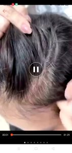 (Chính Hãng) Phủ Bạc Thanh Xuân Huyền Phi - Thảo Dược Từ Thiên Nhiên