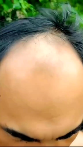 Minyak Kemiri Bakar & Murni Asli 100% - Penumbuh Rambut Brewok Alis Bulumata perawatan rambut pelurus rambut pria dan wanita