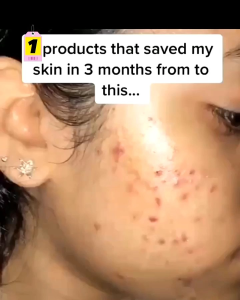 GLUTA SOAP BY ALIANAZIRA MENGHILANGKAN JERAWAT DAN PARUT JERAWAT MENCERAHKAN KULIT WAJAH MEMUDARKAN JERAGAT & MENGHILANGKAN MASALAH KULIT WAJAH YANG BERMINYAK