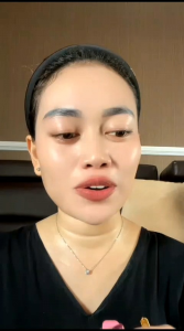 Brightening Lip Serum NLS Skincare Original 100% BPOM RI Aman bumil busui Serum Bibir Pemutih Nls Dermacare Lip Serum 5Pcs Bahan Alami Untuk Kecantikan Bibir - Lazada