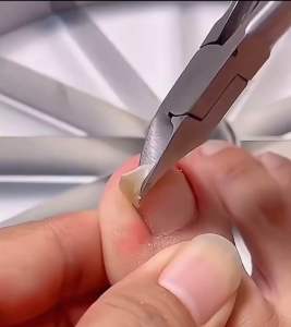 แท้เสริมคีมตัดแสดงผิวหนัง กรรตามการตัดเล็บสแตนเลสคีมตัด ร่างกายกรรที่ตายและกรรตามสไตล์ Onychomycosis ingrowing
