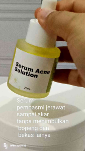 Serum acne glow bebas jerawat dan bopeng 20ml