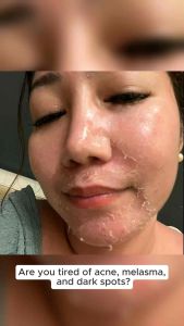 SCD Peeling Lotion Trial Sachet (30g) w/ FREEBIES