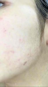 [แถมถุงตีฟอง ซื้อ3ก้อนแถมกิ๊ฟติดผม]สบู่เนริสต้า {ส่งไว} (มีพร้อมส่งแพ็คเกจใหม่ล็อตล่าสุด) ออแกนิก100% ผิวแพ้ง่ายใช้ได้ ของแท้