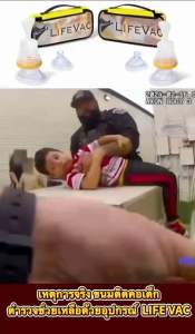 LifeVacUSA อุปกร์ช่วยเหลือการสำลักอาหาร สินค้าแท้100% จากสหรัสอเมริกา พร้อมส่ง!!ตรงจากไทย เครื่องช่วยดูดเศษอาหารติดคอ สำหรับเด็กและผู้ใหญ่ อุปกรณ์