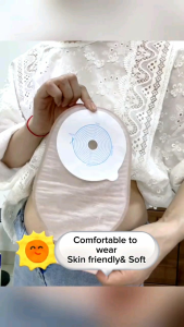 10pcs Medical Grade Stoma Colostomy Bag Cut Size 15-60mm One-Piece System Ostomy Bag Stoma Medicals Drainable Pouch