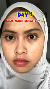 PROMO TERMURAH‼️ FLASH SALE: Byzoe Platinum Glow Glowing Booster Jelly Moisturizer Skincare Official Store