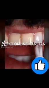 CEPAT PEMUTIH GIGI DAZZLING WHITE MUDAH DIPAKAI BISA DIBAWAK KEMANA SAJA