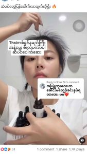 JEE HERB FOR HAIR LOSS HAIR TONIC မြန်မာစတေကာပါတယ်ရှင့်