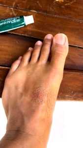 3 PCS Salep Cream Lumbar ORIGINAL ASLI Mengobati Sakit Pinggang Nyeri otot dan kesemutan lumbar gold compres gel