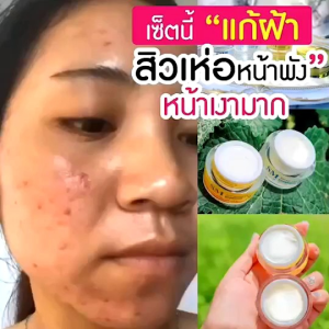 ครีมรกพืช SM ขนาด 15 กรัม 100% รูปแบบ 100% ของแท้