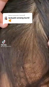 Shampo Pemanjang Rambut Penghilang Kutu dan Telurnya Ampuh Cegah Ketombe Gatal Lepek Kerontokan Rambut Shampoo Shanas Premium Touch PRO NASA Original BPOM