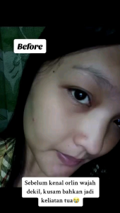 Paket Brightening Glow Skincare untuk Wajah Susah Putih