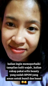 Paket Brightening Tanpa Night Cream dari Orlin Beauty: Menyehatkan & Mencerahkan Kulit Dalam 10 Hari