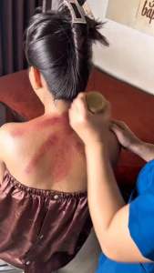 DUNG DỊCH XOA BÓP THẢO DƯỢC DR CELL MỘC LÂM AN CẢI THIỆN ĐAU NHỨC XƯƠNG KHỚP TÊ BÌ CHÂN TAY MÙI HƯƠNG ĐUỔI CÔN TRÙNG CHAI 400ML