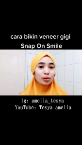 [ ORIGINAL ] GIGI PALSU TELARIS DAPAT 1 SET ATAS BAWAH SNAP ON SMILE ORIGINAL 100%